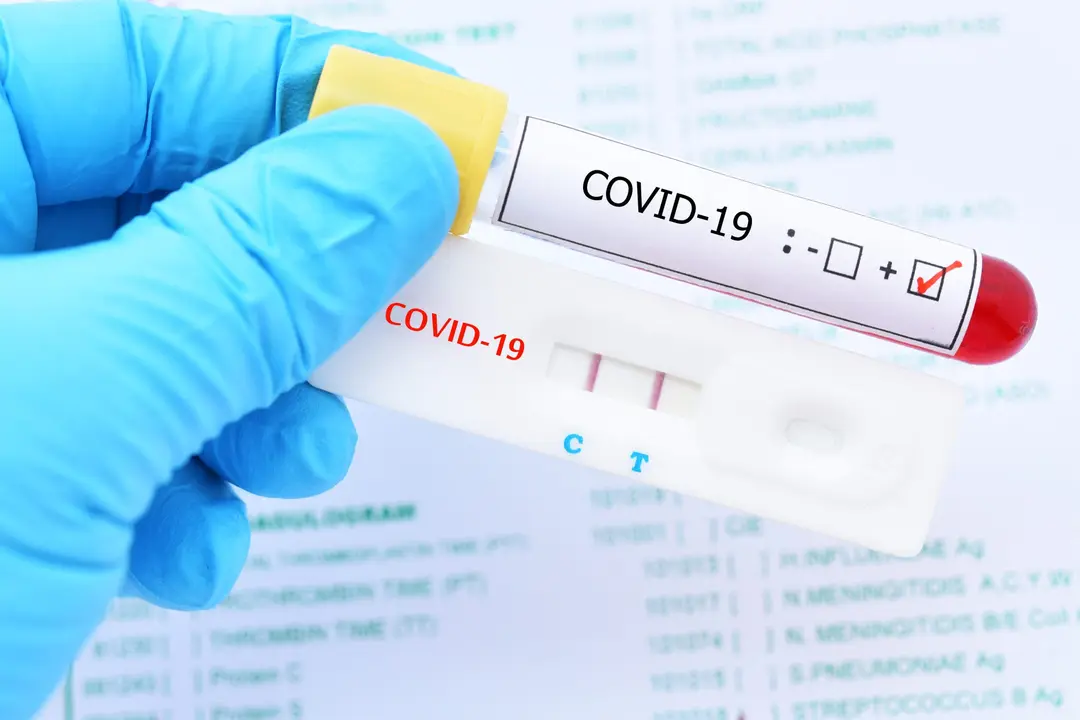 Positive test result by using rapid test device for COVID-19 virus, novel coronavirus 2019 found in Wuhan, China