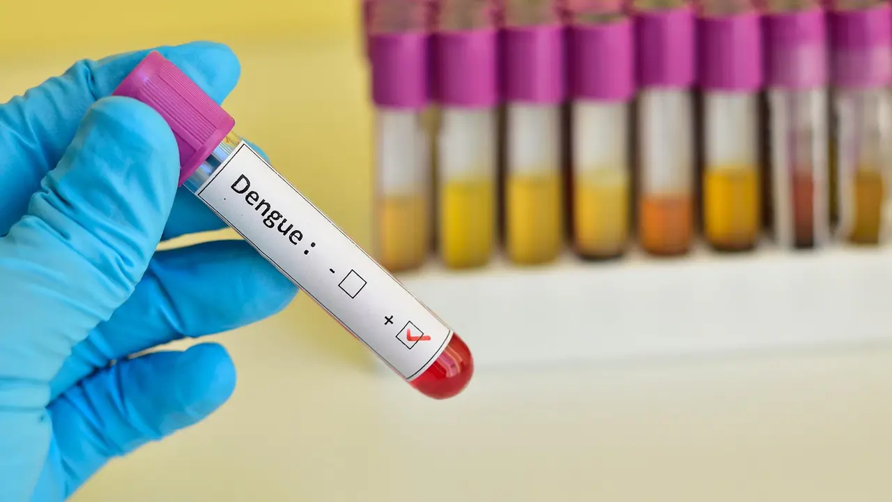 Blood sample positive with dengue virus