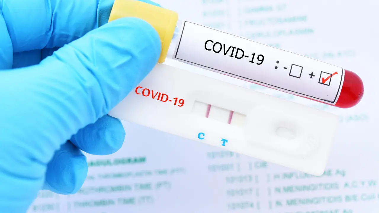 Positive test result by using rapid test device for COVID-19 virus, novel coronavirus 2019 found in Wuhan, China