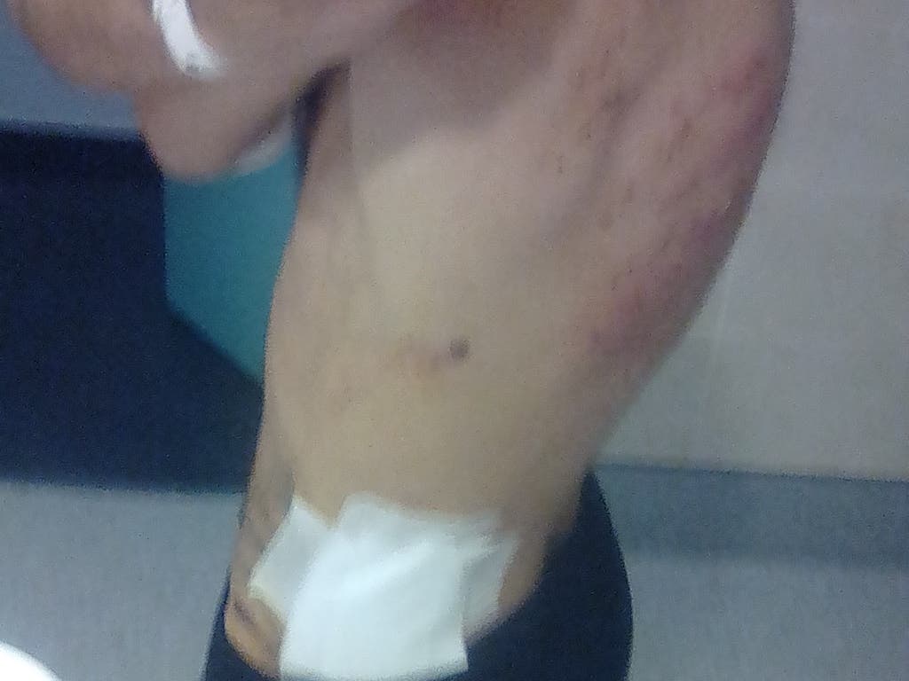 Muestra las heridas.