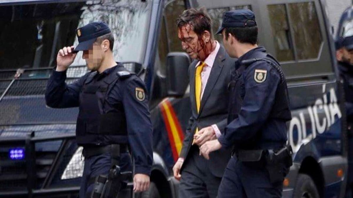 Resuelto El Misterioso Asalto Al Doctor Frade En Madrid Miracorredor