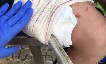 Un niño de Carabaña en estado grave tras clavarse un palo en el muslo