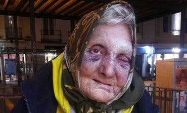 La Policía investiga la brutal agresión a una anciana sin techo en Madrid
