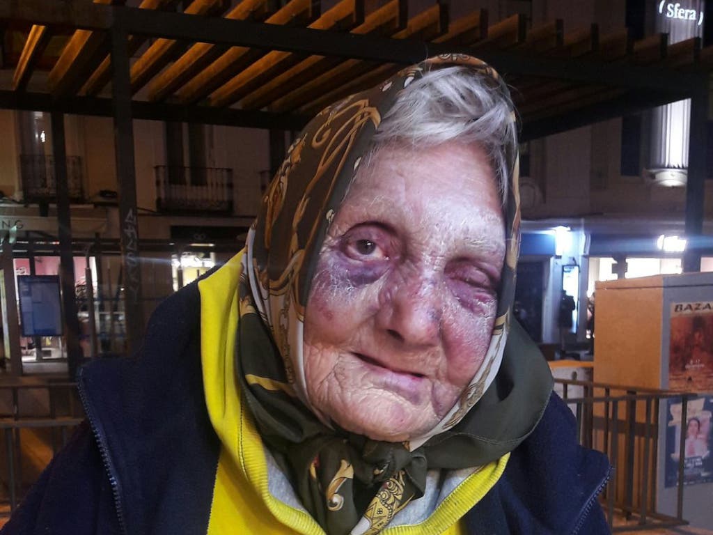 La Policía investiga la brutal agresión a una anciana sin techo en Madrid