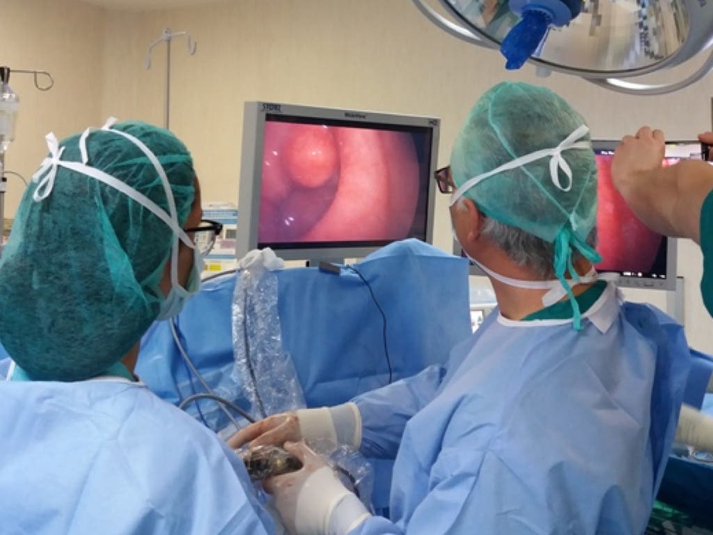 El Hospital del Henares extirpa un tumor con una técnica pionera en España 