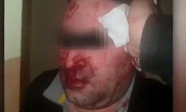 Brutal agresión a un vigilante en el Centro de Menores de Hortaleza