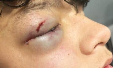 Brutal agresión a un menor en Vallecas