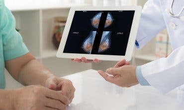 La Paz aplica un tratamiento pionero contra el cáncer de mama