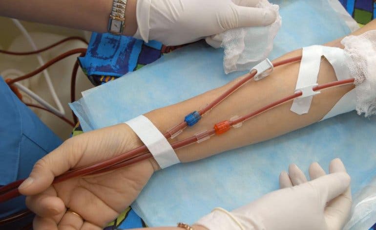 El Hospital del Sureste comienza a utilizar la hemodiálisis domiciliaria