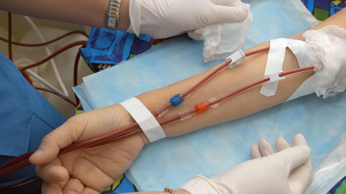 El Hospital del Sureste comienza a utilizar la hemodiálisis domiciliaria