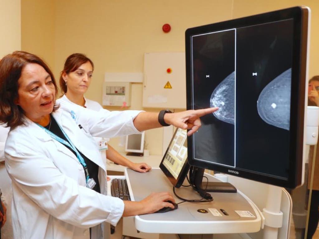 El Hospital de Torrejón incorpora un mamógrafo puntero en la sanidad pública madrileña