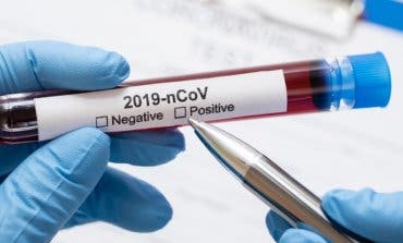 Sanidad notifica 8.581 nuevos casos de coronavirus, 3.663 en las últimas 24 horas
