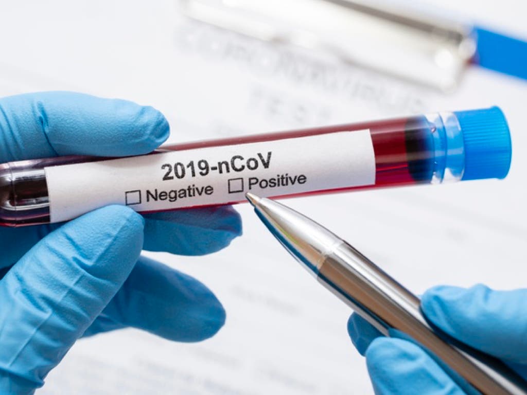 España registra 124 nuevos contagios de coronavirus en 24 horas