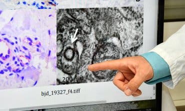 El Hospital Niño Jesús logra «fotografiar» el coronavirus en la piel de los niños
