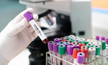España registra 2.759 casos de Covid-19 en 24 horas, 491 en Madrid