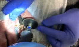 Los Bomberos acuden al Hospital de Torrejón de Ardoz para cortar un anillo atascado 