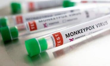 España sigue siendo el país europeo com más casos de viruela del mono, 6.459