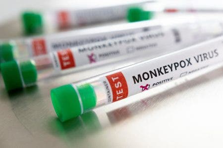 España sigue siendo el país europeo com más casos de viruela del mono, 6.459