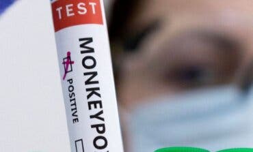 Madrid registra su primera muerte de una persona con viruela del mono 