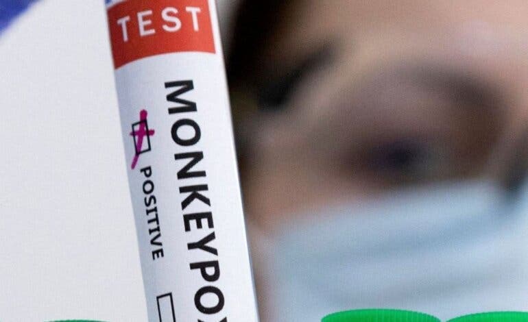 Madrid registra su primera muerte de una persona con viruela del mono 