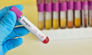 Madrid registra un aumento de casos de dengue, todos ellos importados