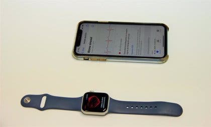 Salvan la vida a un hombre en un hospital de Madrid con un Apple Watch