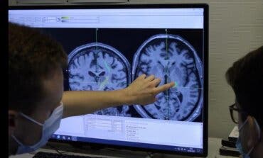 Nuevo hito de la sanidad madrileña: reducen un 80% el temblor del párkinson con una nueva técnica 