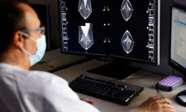 La Comunidad de Madrid aumenta un 17% las mamografías preventivas de cáncer