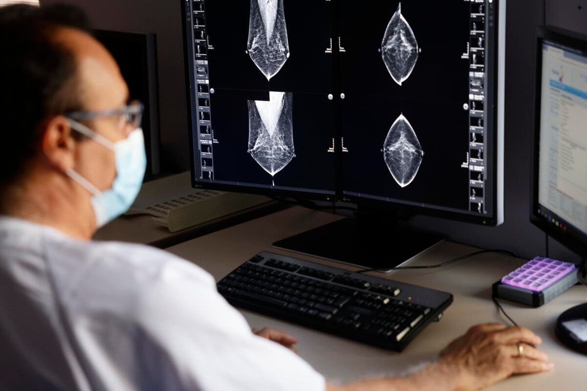 La Comunidad de Madrid aumenta un 17% las mamografías preventivas de cáncer