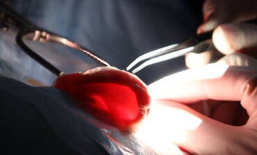 Importante avance contra la sordera en el Hospital de Torrejón