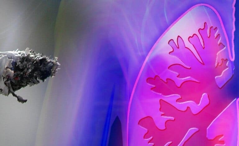 Madrid lidera un proyecto europeo que persigue revolucionar el tratamiento de pacientes con cáncer de pulmón