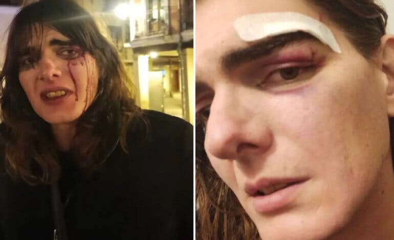 Denuncian una brutal agresión a una mujer trans en Alcalá de Henares