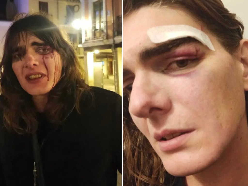 Denuncian una brutal agresión a una mujer trans en Alcalá de Henares