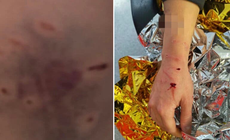 El pitbull de unos narcos ataca gravemente a una agente en Madrid y es abatido por la Policía 