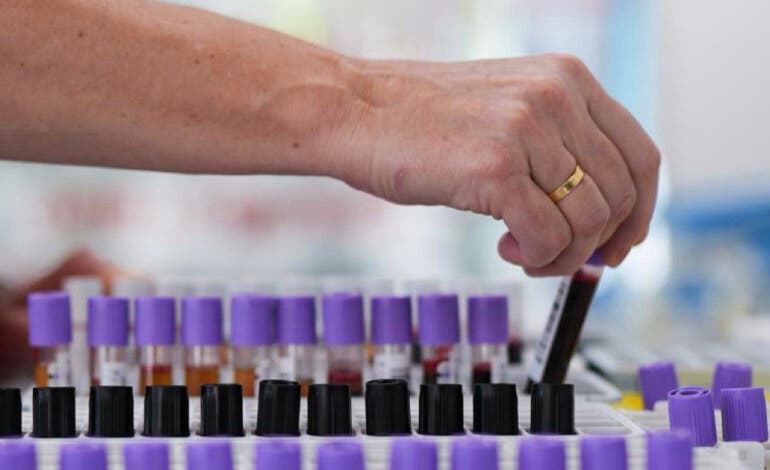 La Comunidad de Madrid pide donaciones urgentes de sangre ante la alerta roja en seis grupos y el déficit de plaquetas