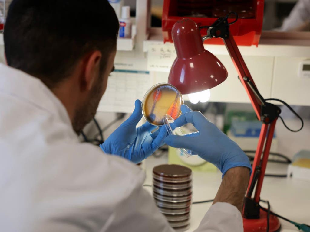 La Comunidad de Madrid detecta el primer caso de viruela del mono de tipo clado 1b por transmisión autóctona