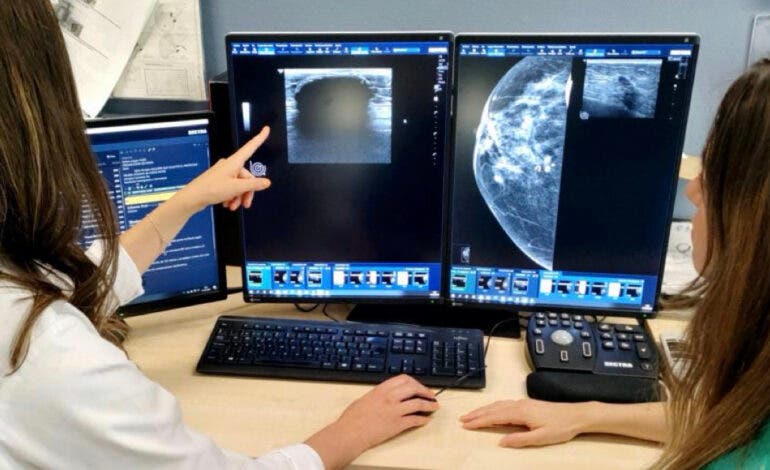 Seis hospitales madrileños participan en el ensayo de un fármaco que mejora la supervivencia en cáncer de mama