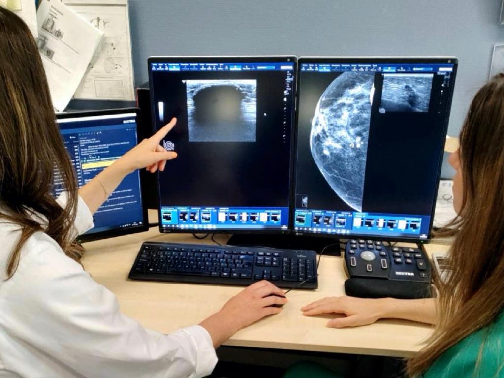 Seis hospitales madrileños participan en el ensayo de un fármaco que mejora la supervivencia en cáncer de mama