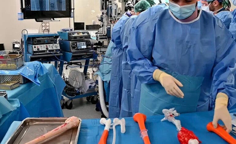 La sanidad pública de Madrid salva la pierna a un niño con un tumor óseo gracias a una cirugía pionera