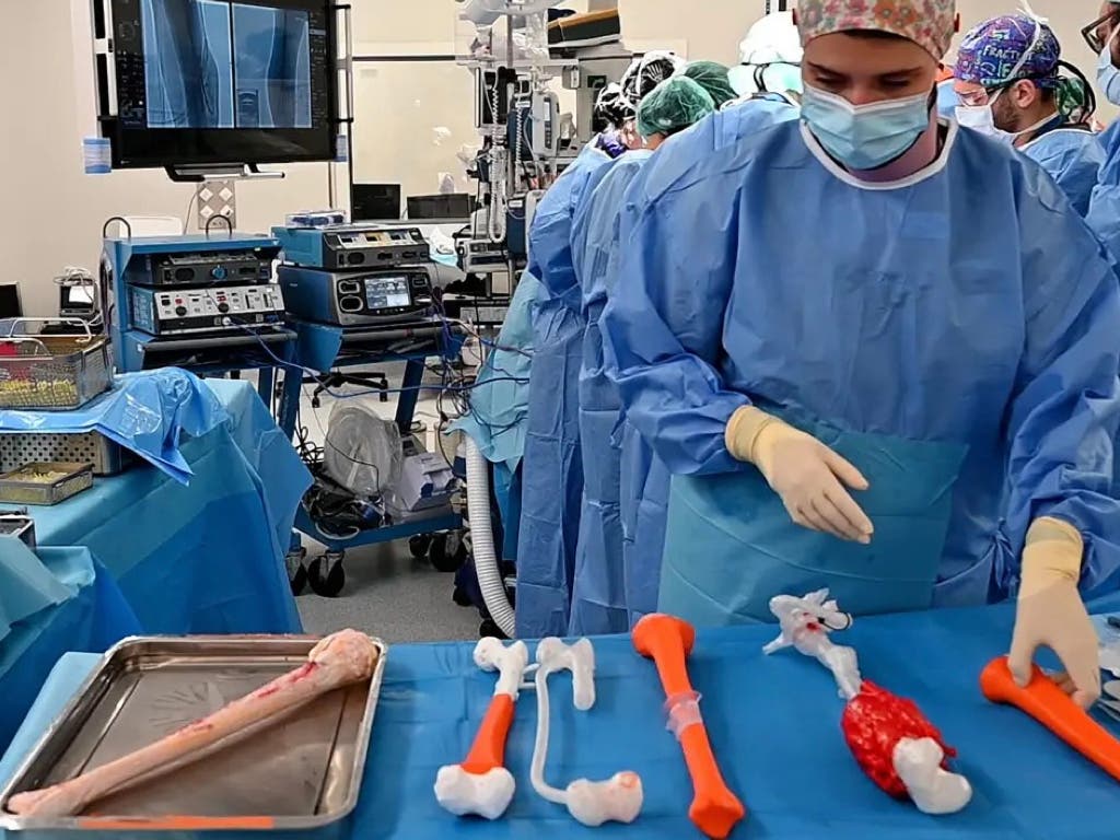 La sanidad pública de Madrid salva la pierna a un niño con un tumor óseo gracias a una cirugía pionera